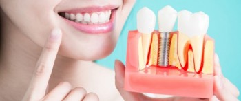 Experienced Dentist in Kew |  Hawthorn East Dental