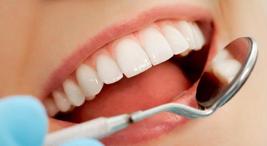 Teeth whitening sydney | Bondi Beach Dental