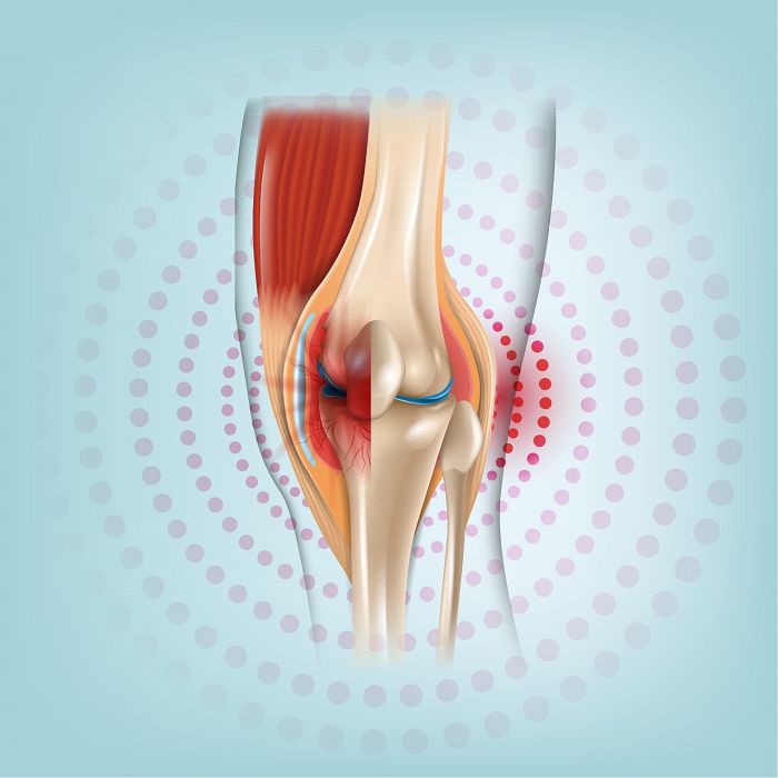 Rheumatoid Arthritis Immunoassay82