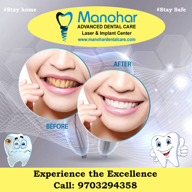 root canal doctor in vizag |Manohar dental care 