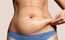 Effective Coolsculpting Templestowe in Melbourne - Contact Us Now!