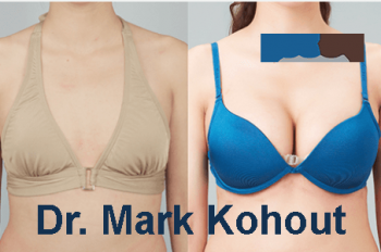 Tummy tuck surgeon Sydney