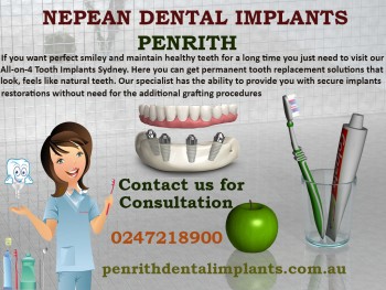 Affordable All-on-4 Dental tooth Implants at best prices in Penrith