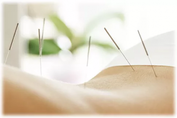 Maroubra Balance Physiotherapy & Acupuncture