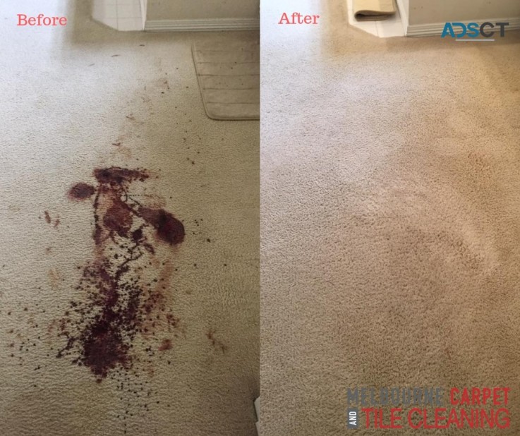 Best Carpet Cleaning Service in Dandenong