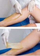 Skin Nexus - Hair Removal & IPL/RF Clinic