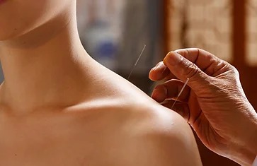 Camberwell Acupuncture and Chinese Medicine