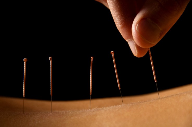 Restore Acupuncture