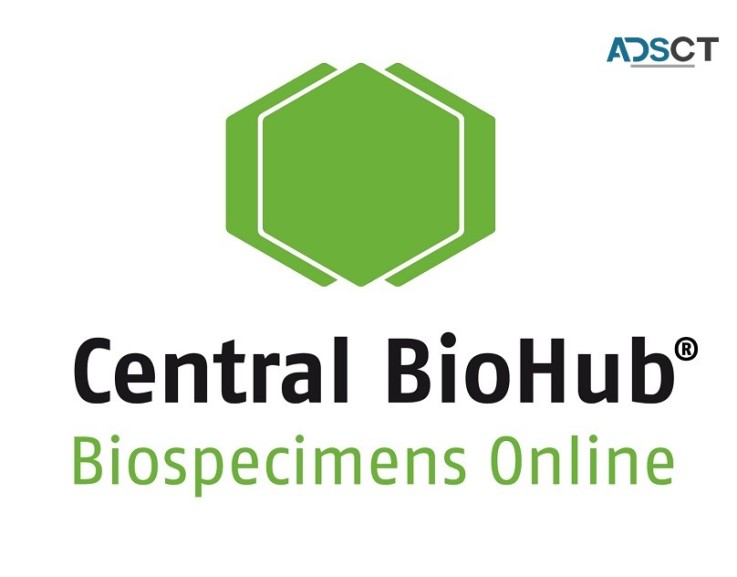 Human PBMC Samples | Order Biospecimens Online