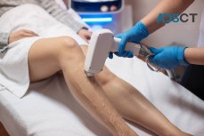 Laser Hair Removal Sydney