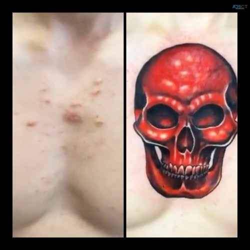 Tattoo Cover-Up at Art n Soul Tattoo Studio